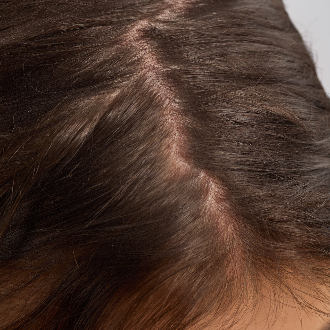 kitsch-strengthening-rosemary-biotin-scalp-hair-oil-3er-pack image 7