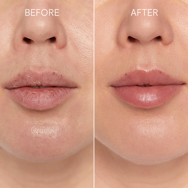 glov-scrubex-lippenpeeling-handschuh-akcesorium-do-peelingu-ust image 2